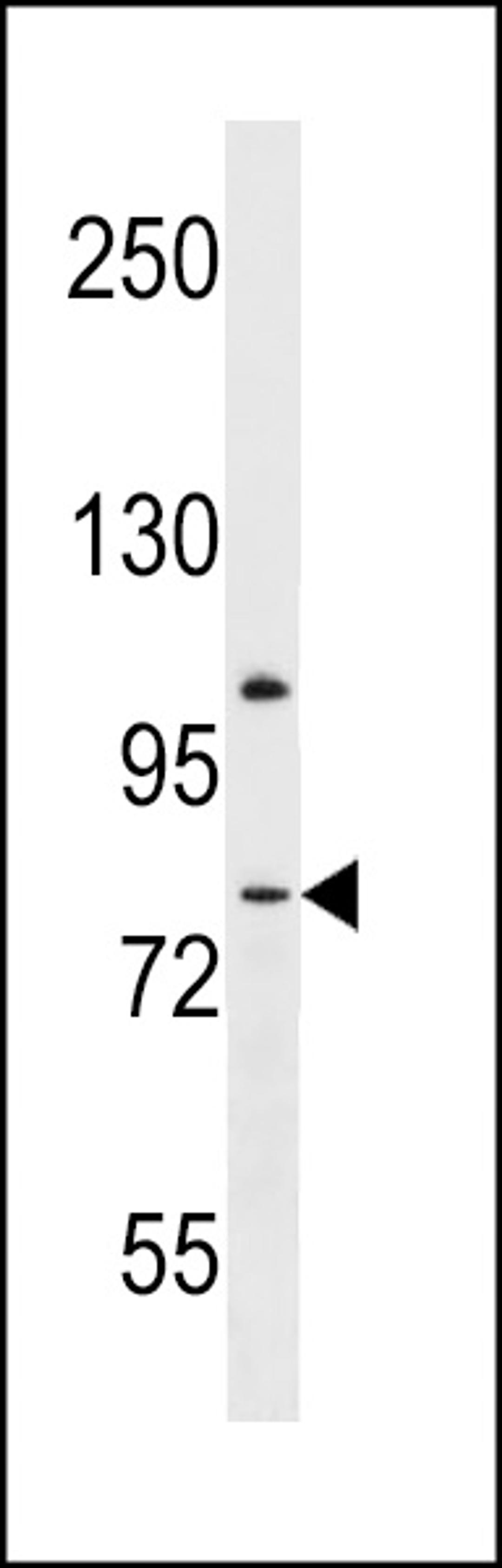 Western blot analysis in mouse spleen tissue lysates (35ug/lane).