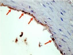 Immunohistochemical staining of mouse endothelial cells using HA EPITOPE TAG antibody