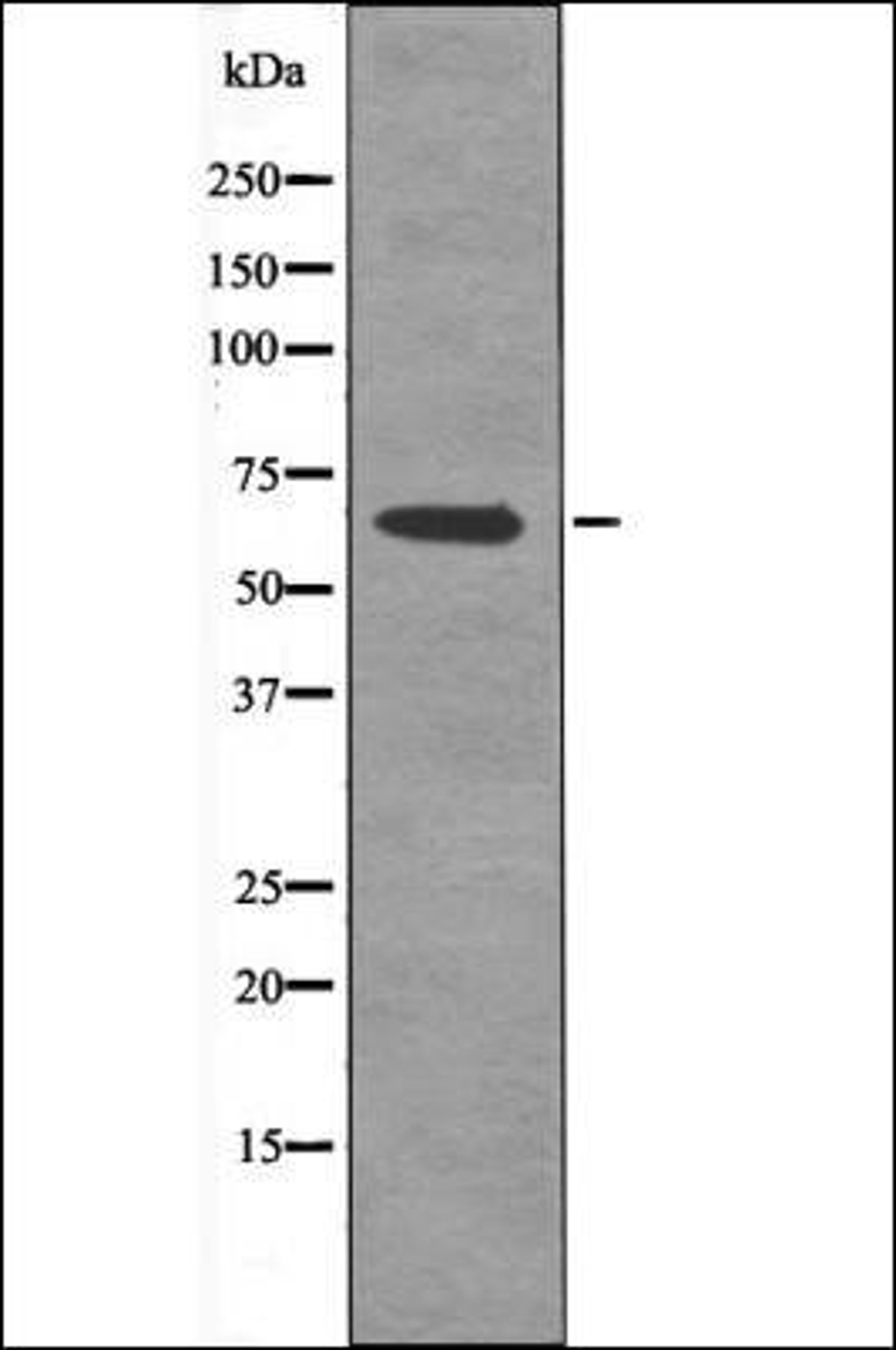 Western blot analysis of Forskolin treated 293 whole cell lysates using AFX1 -Phospho-Thr455- antibody