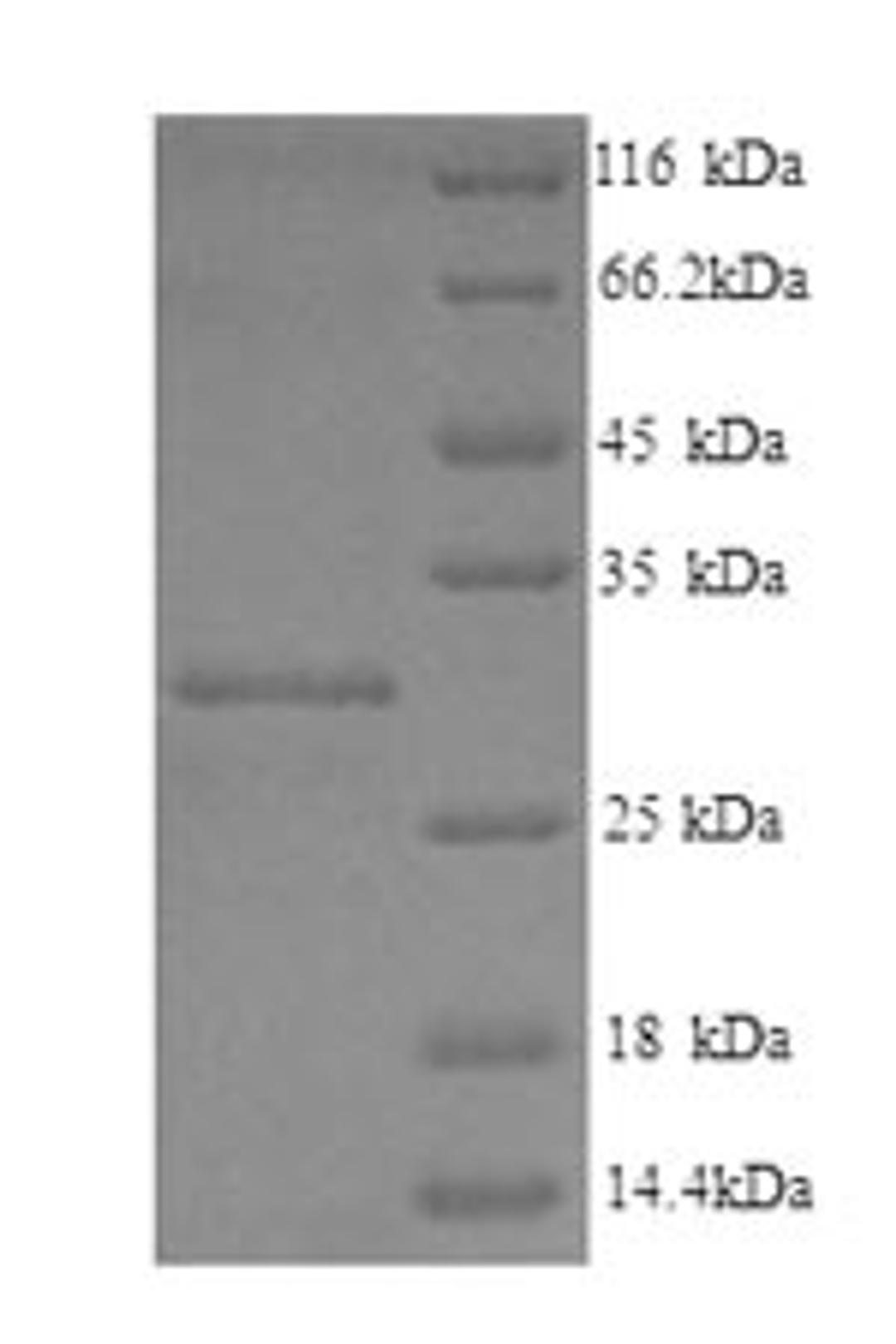 (Tris-Glycine gel) Discontinuous SDS-PAGE (reduced) with 5% enrichment gel and 15% separation gel.