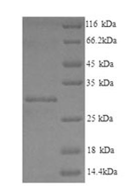 (Tris-Glycine gel) Discontinuous SDS-PAGE (reduced) with 5% enrichment gel and 15% separation gel.