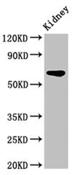 Western Blot. Positive WB detected in: Rat kidney tissue. All lanes: IPP antibody at 3.2ug/ml. Secondary. Goat polyclonal to rabbit IgG at 1/50000 dilution. Predicted band size: 66 kDa. Observed band size: 66 kDa.