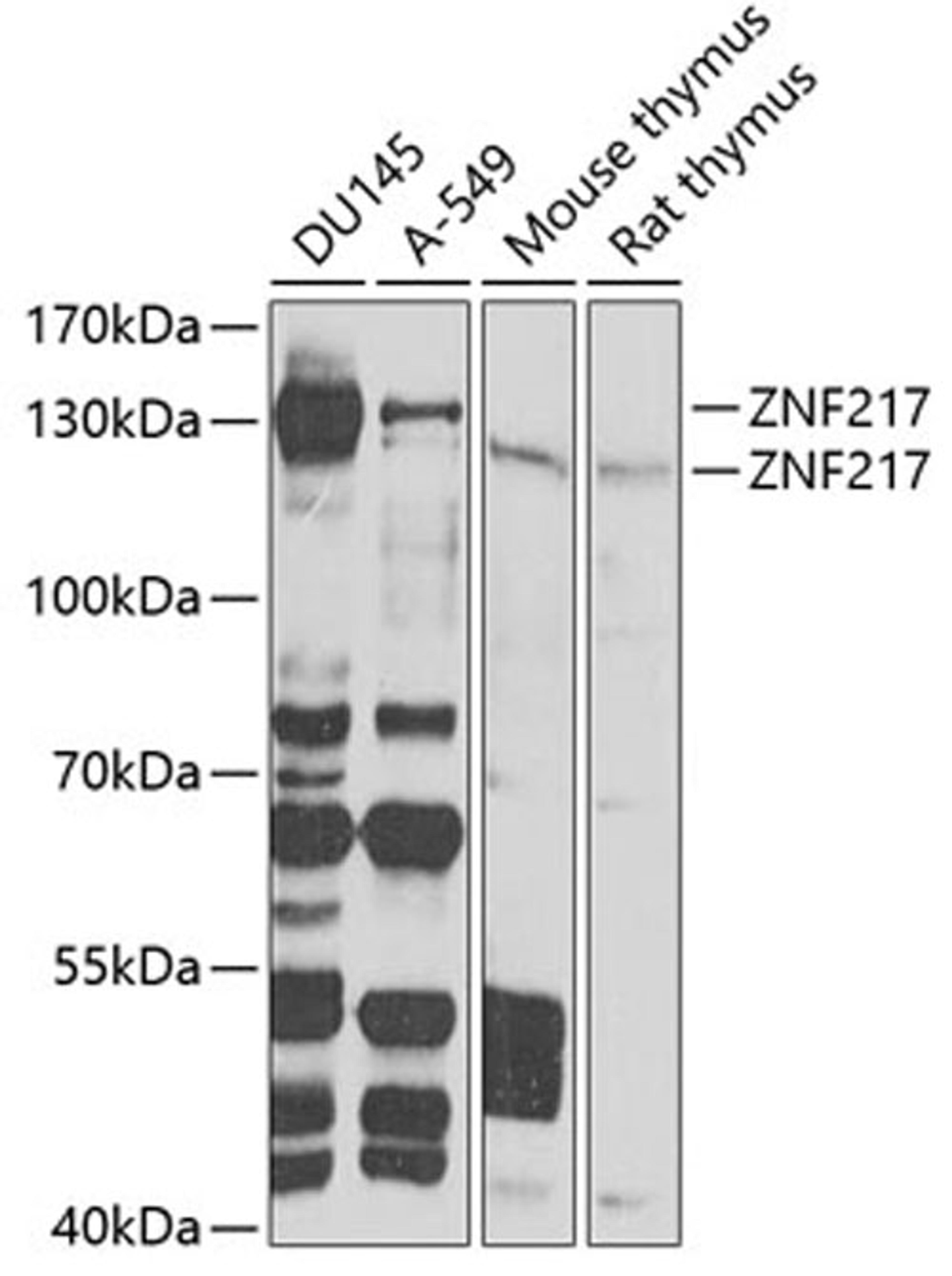 Western blot - ZNF217 Antibody (A7002)