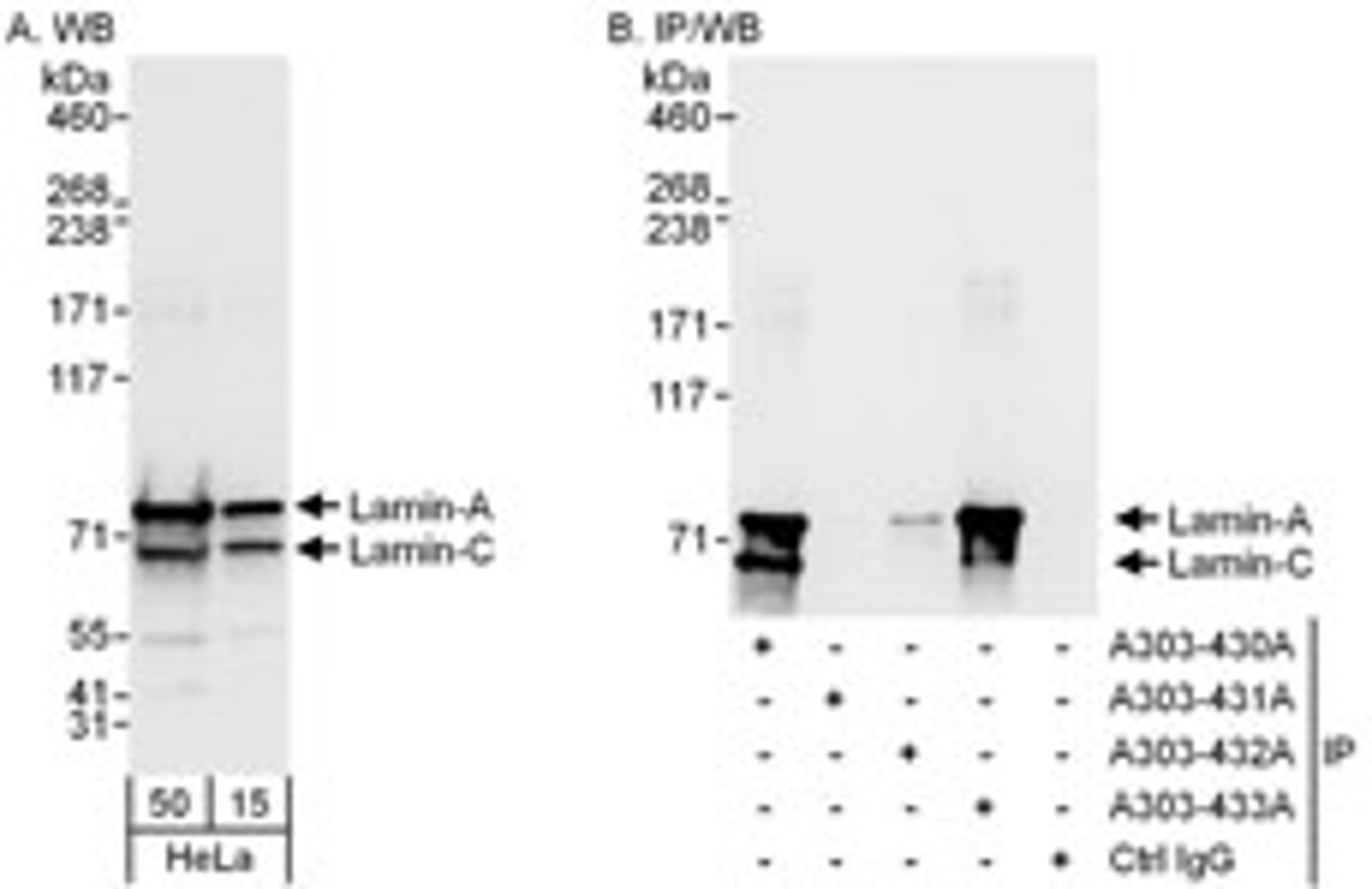 Detection of human Lamin-A and Lamin-C by western blot and immunoprecipitation.