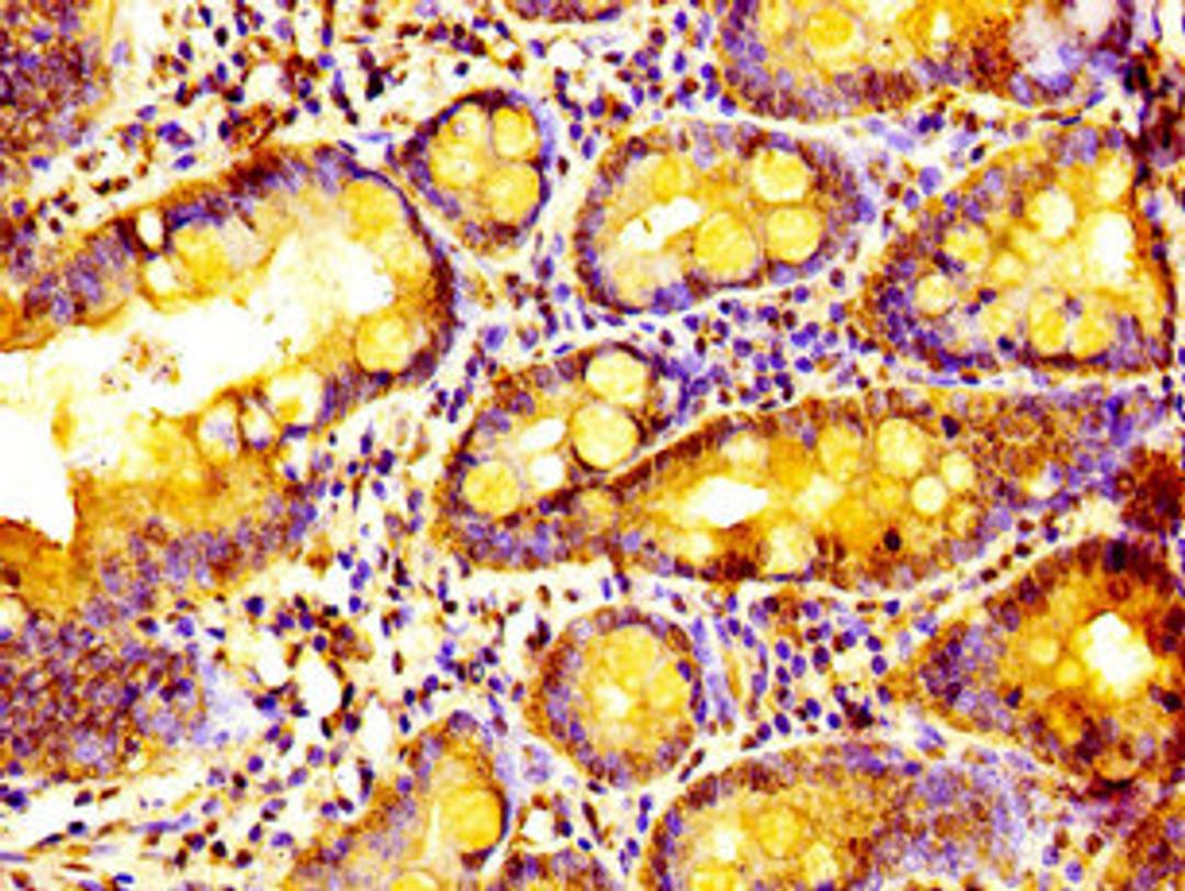 Immunohistochemistry of paraffin-embedded human small intestine tissue using CSB-PA774811LA01HU at dilution of 1:100