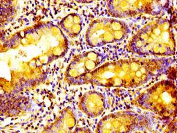 Immunohistochemistry of paraffin-embedded human small intestine tissue using CSB-PA774811LA01HU at dilution of 1:100