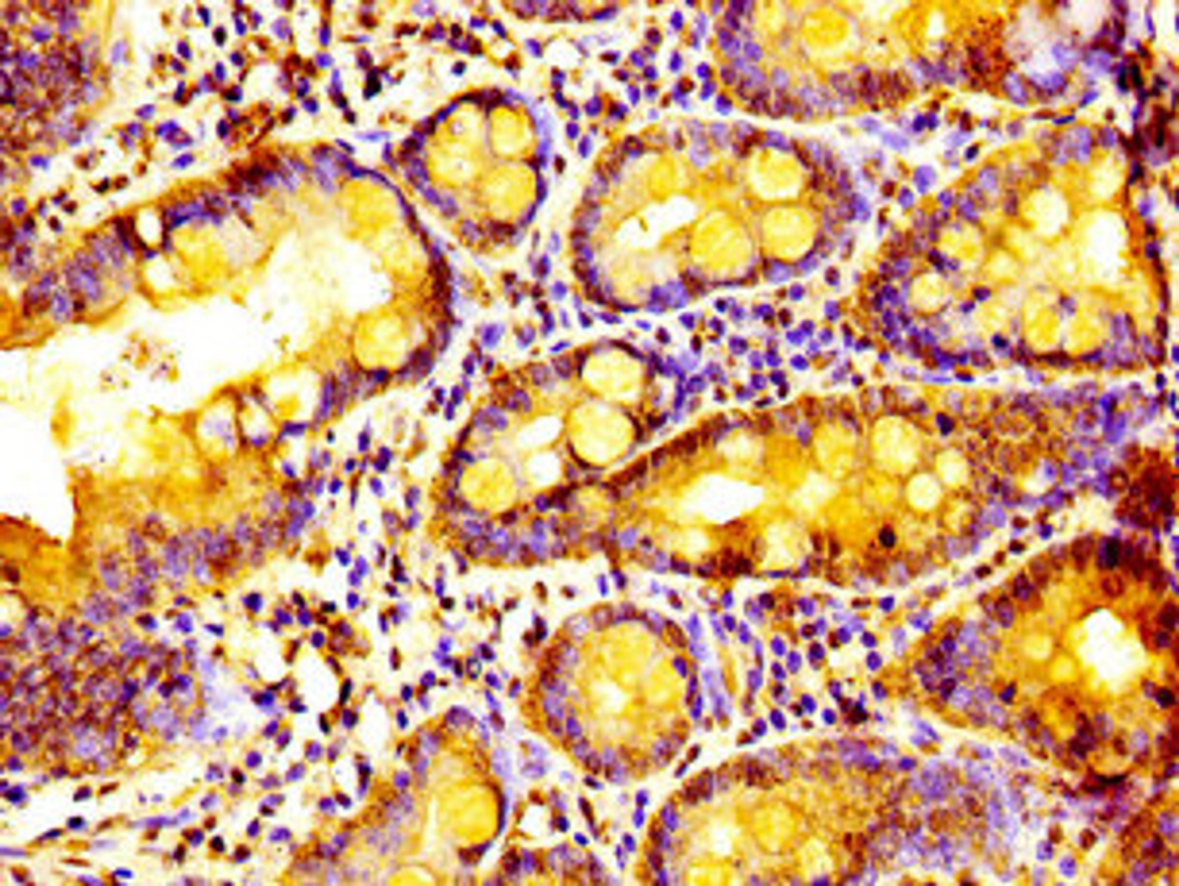 Immunohistochemistry of paraffin-embedded human small intestine tissue using CSB-PA774811LA01HU at dilution of 1:100
