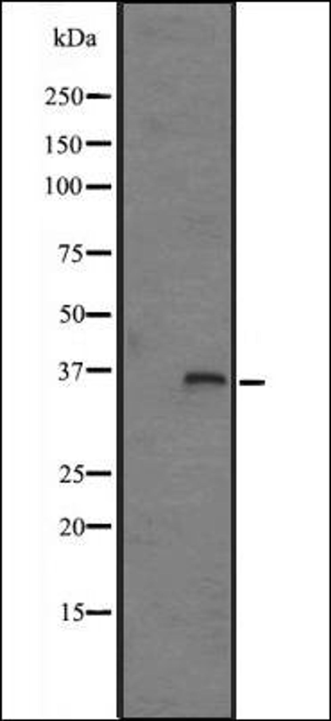 Western blot analysis of HepG2 cell lysate using FN3K antibody