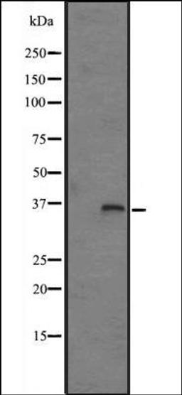 Western blot analysis of HepG2 cell lysate using FN3K antibody