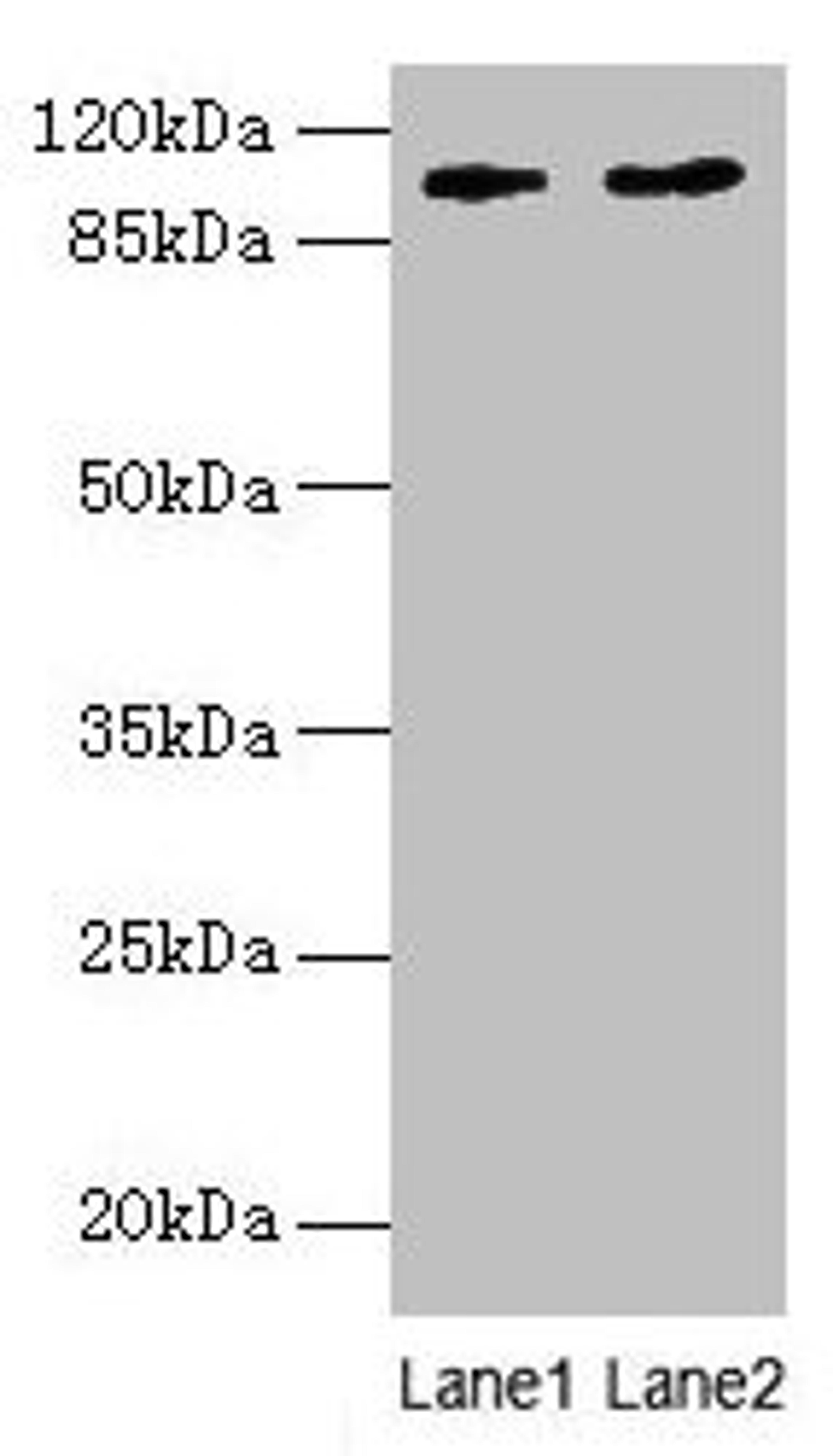 Western blot. All lanes: CCDC57 antibody at 1.2µg/ml. Lane 1: PC-3 whole cell lysate. Lane 2: HepG2 whole cell lysate. Secondary. Goat polyclonal to rabbit IgG at 1/10000 dilution. Predicted band size: 104, 86 kDa. Observed band size: 104 kDa