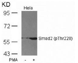 Western Blot: Smad2 [p Thr220] Antibody [NBP1-04982] - Extracts from Hela cells untreated or treeated with PMAA using Smadd2 (Phospho-Thhr220) Antibody .