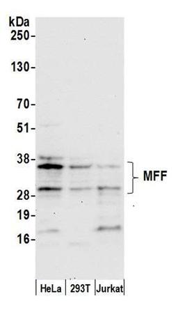 Detection of human MFF by WB.