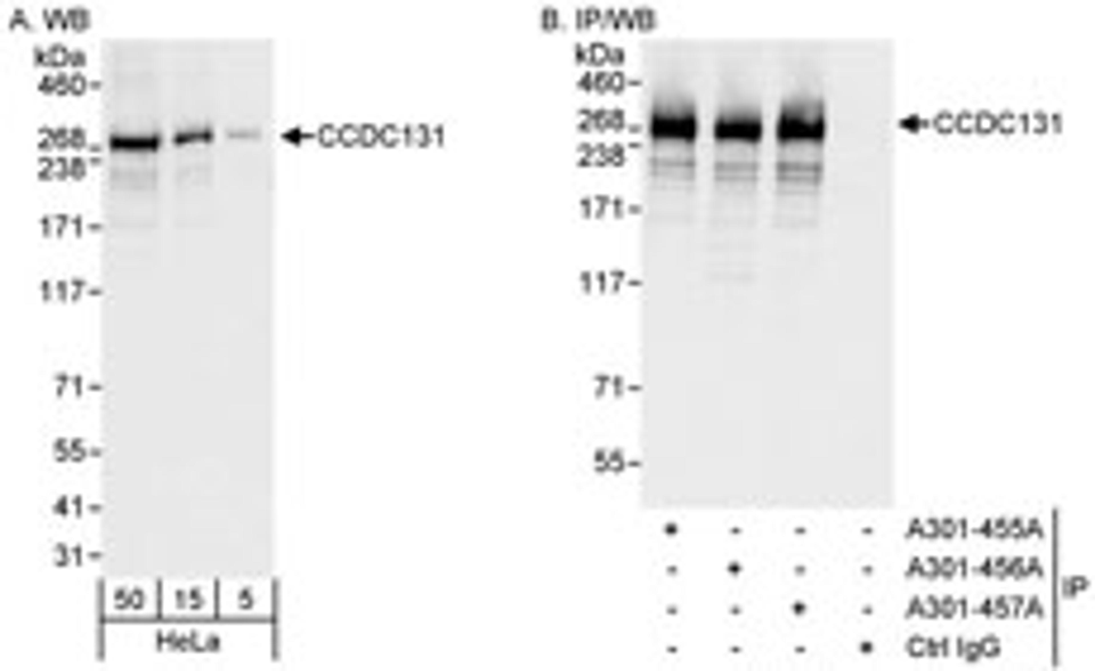 Detection of human CCDC131 by western blot and immunoprecipitation.