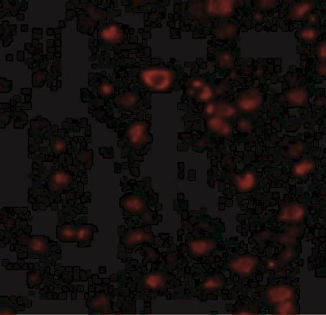 Immunocytochemistry/Immunofluorescence: BRSK1 Antibody [NBP1-76778] - Immunofluorescence of BRSK1 in Human Brain cells with BRSK1 antibody at 20 ug/mL.