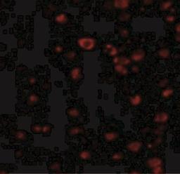 Immunocytochemistry/Immunofluorescence: BRSK1 Antibody [NBP1-76778] - Immunofluorescence of BRSK1 in Human Brain cells with BRSK1 antibody at 20 ug/mL.