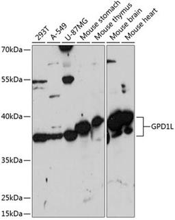 Western blot - GPD1L antibody (A14392)