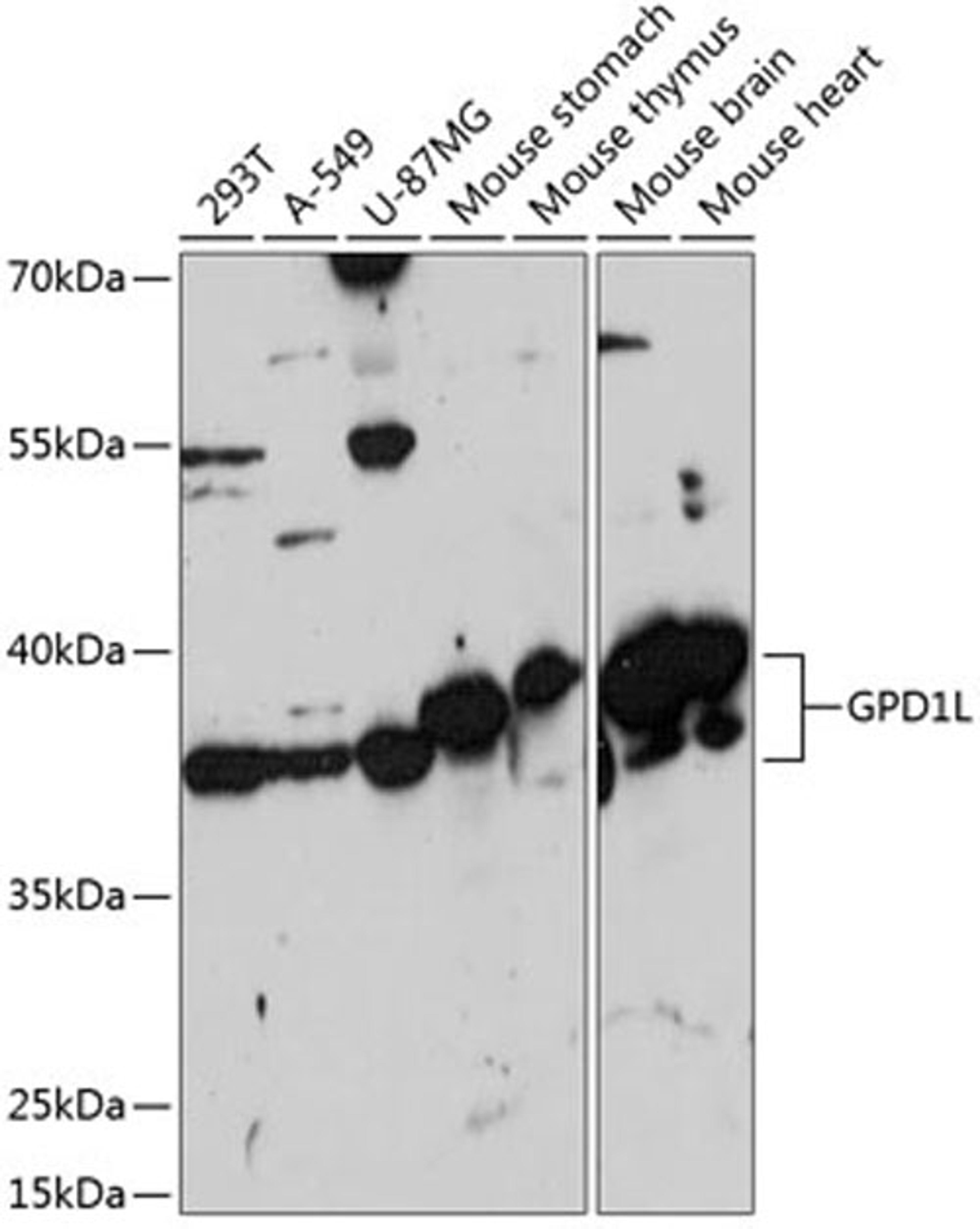 Western blot - GPD1L antibody (A14392)