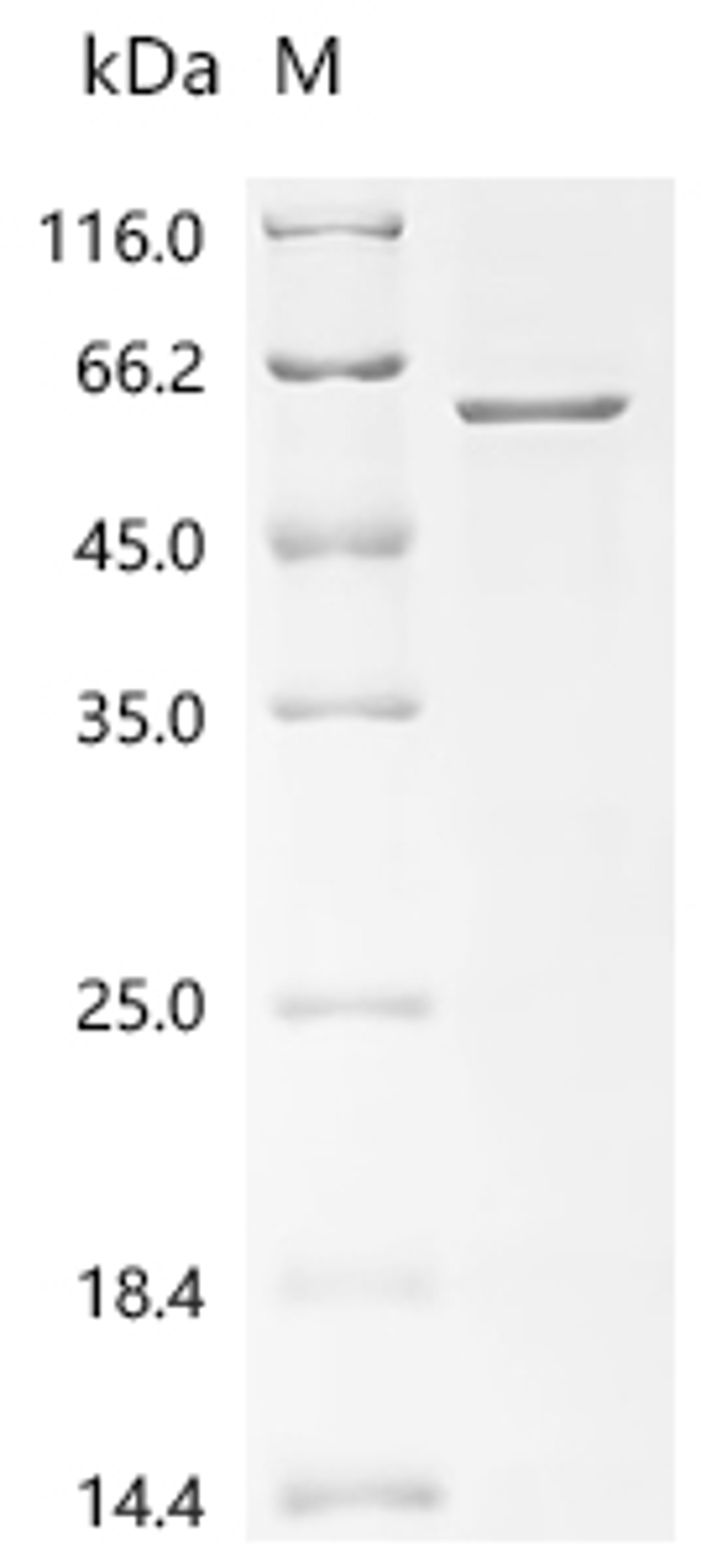 (Tris-Glycine gel) Discontinuous SDS-PAGE (reduced) with 5% enrichment gel and 15% separation gel.