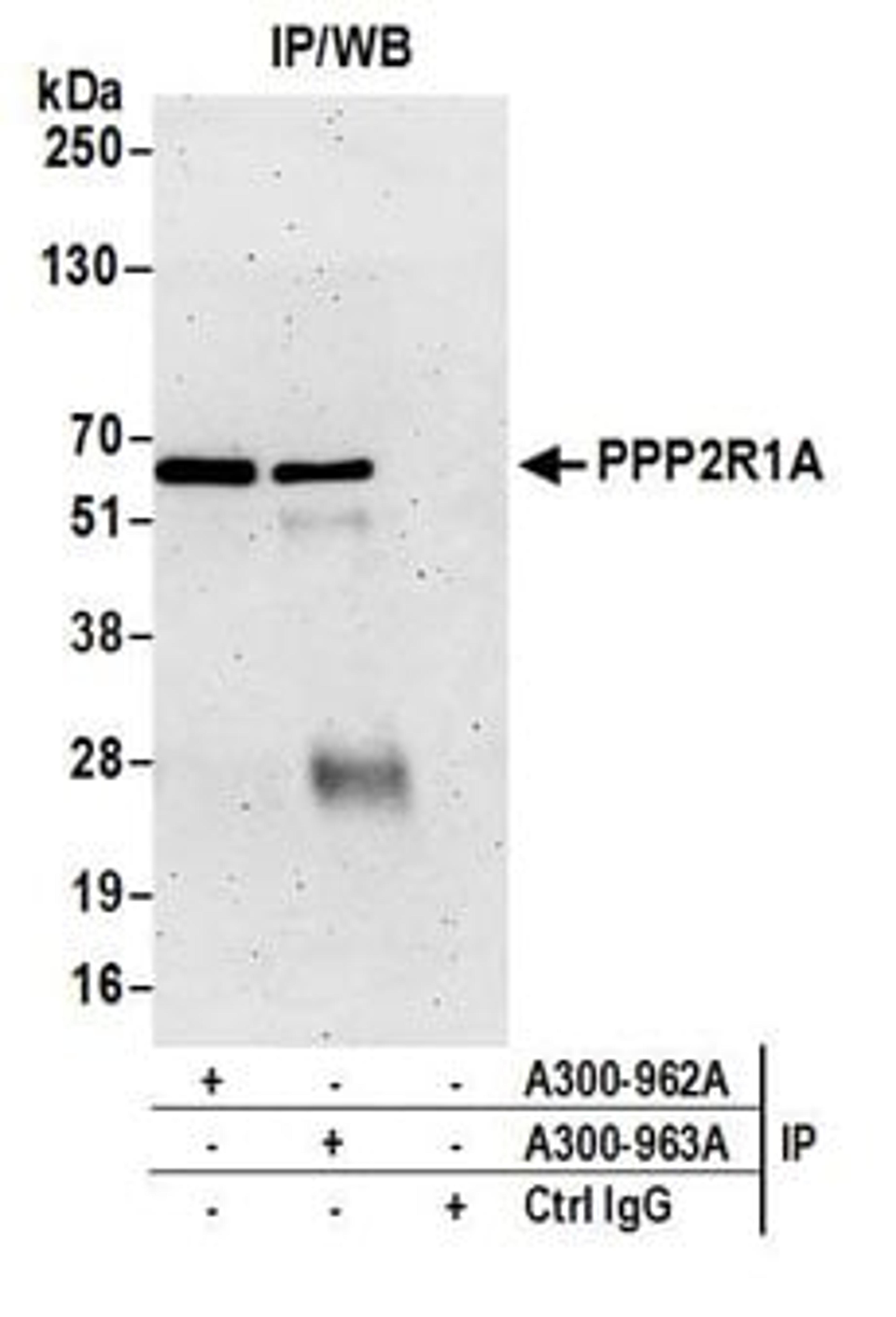 Detection of human PPP2R1A by western blot of immunoprecipitates.