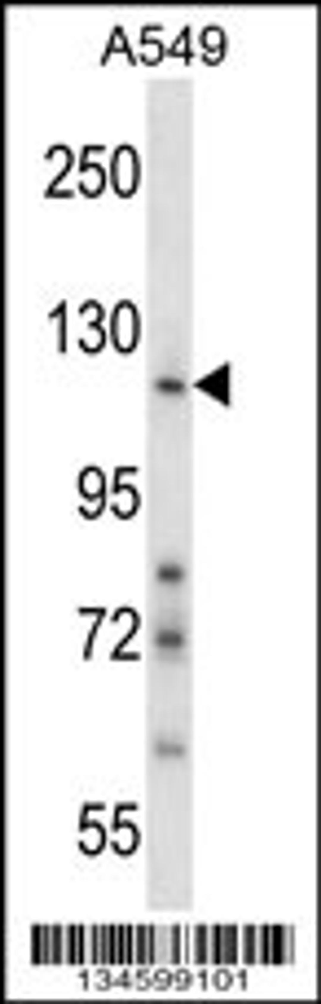 Western blot analysis in A549 cell line lysates (35ug/lane).