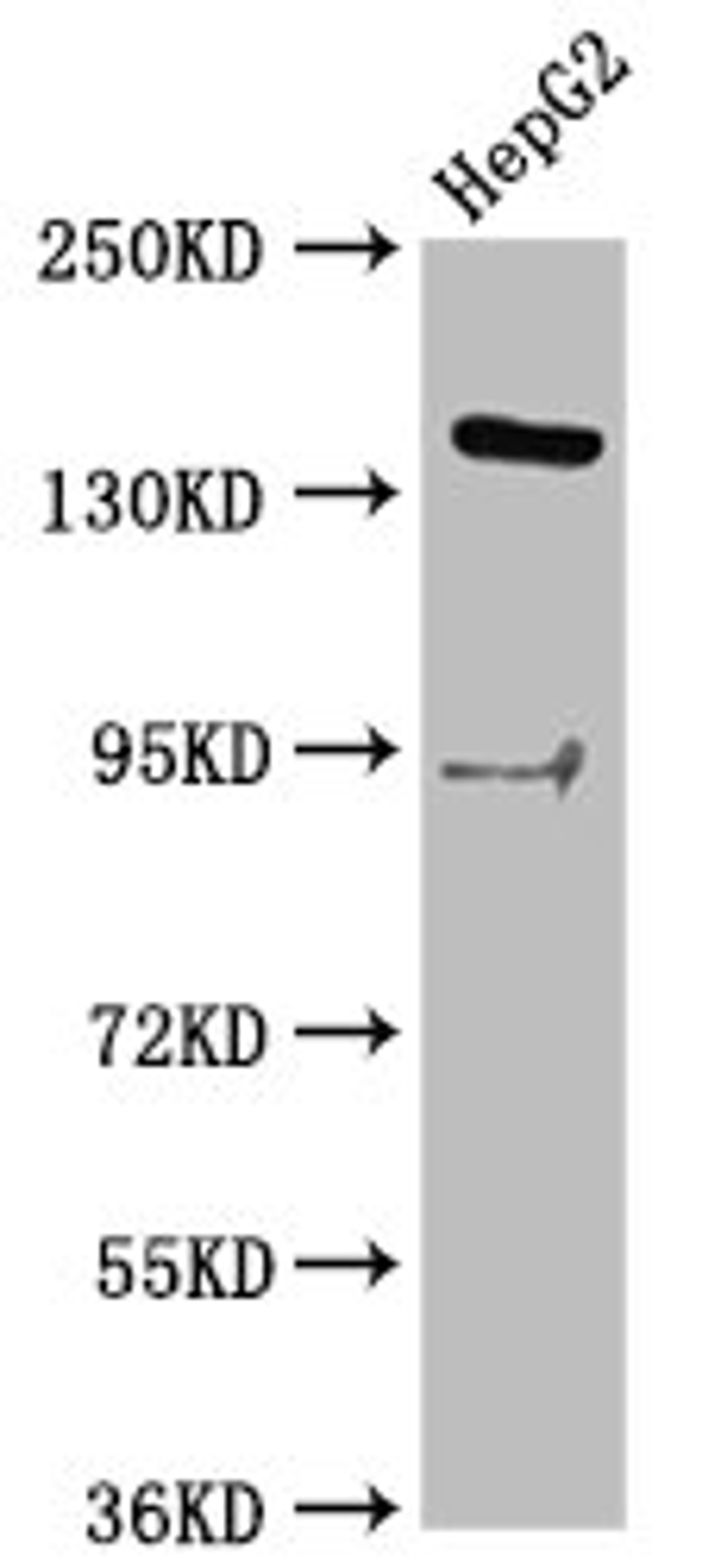 Western Blot. Positive WB detected in: HepG2 whole cell lysate. All lanes: INO80 antibody at 2.9ug/ml. Secondary. Goat polyclonal to rabbit IgG at 1/50000 dilution. Predicted band size: 177 kDa. Observed band size: 177 kDa. 
