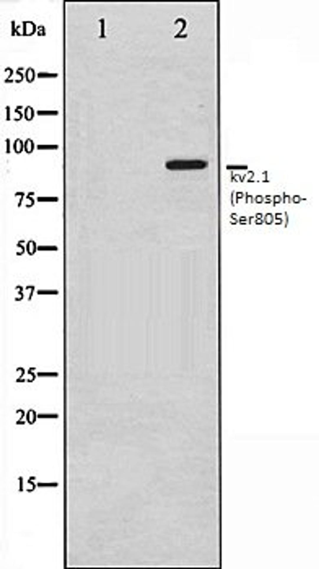 Western blot analysis of K562 whole cell lysates using Kv2.1 (Phospho-Ser805) antibody, The lane on the left is treated with the antigen-specific peptide.