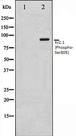 Western blot analysis of K562 whole cell lysates using Kv2.1 (Phospho-Ser805) antibody, The lane on the left is treated with the antigen-specific peptide.