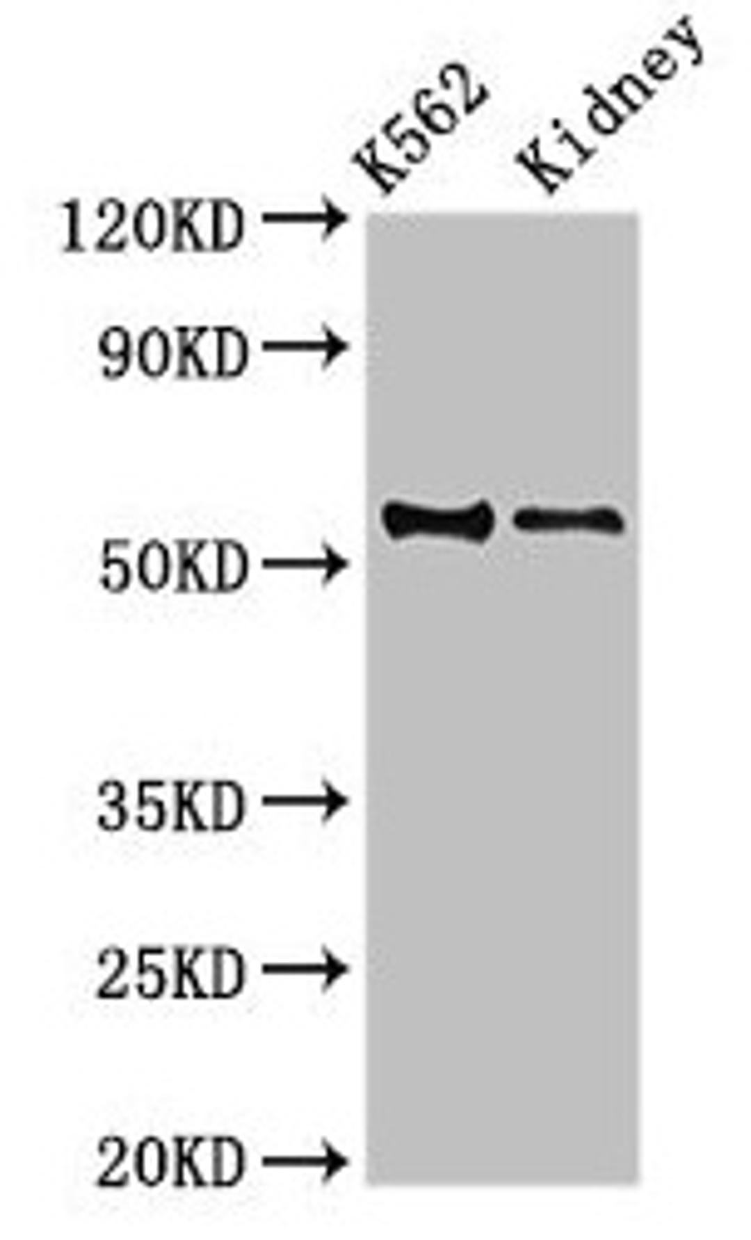 Western Blot. Positive WB detected in: K562 whole cell lysate, Mouse kidney tissue. All lanes: ALDH1A2 antibody at 3.5µg/ml. Secondary. Goat polyclonal to rabbit IgG at 1/50000 dilution. Predicted band size: 57, 54, 55, 47 kDa. Observed band size: 54 kDa