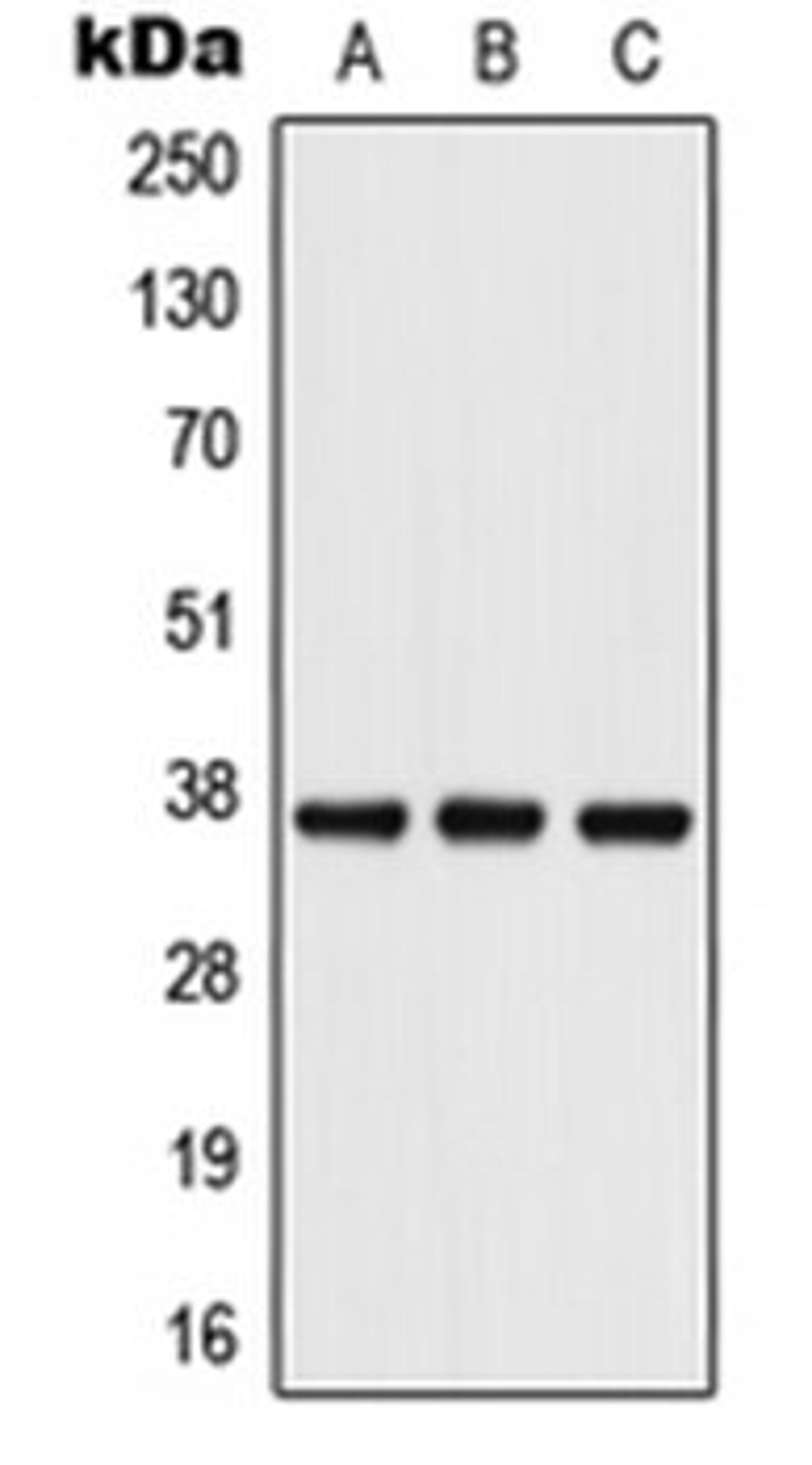 Western blot analysis of HT1080 (Lane 1), Raw264.7 (Lane 2), PC12 (Lane 3) whole cell lysates using PDPN antibody