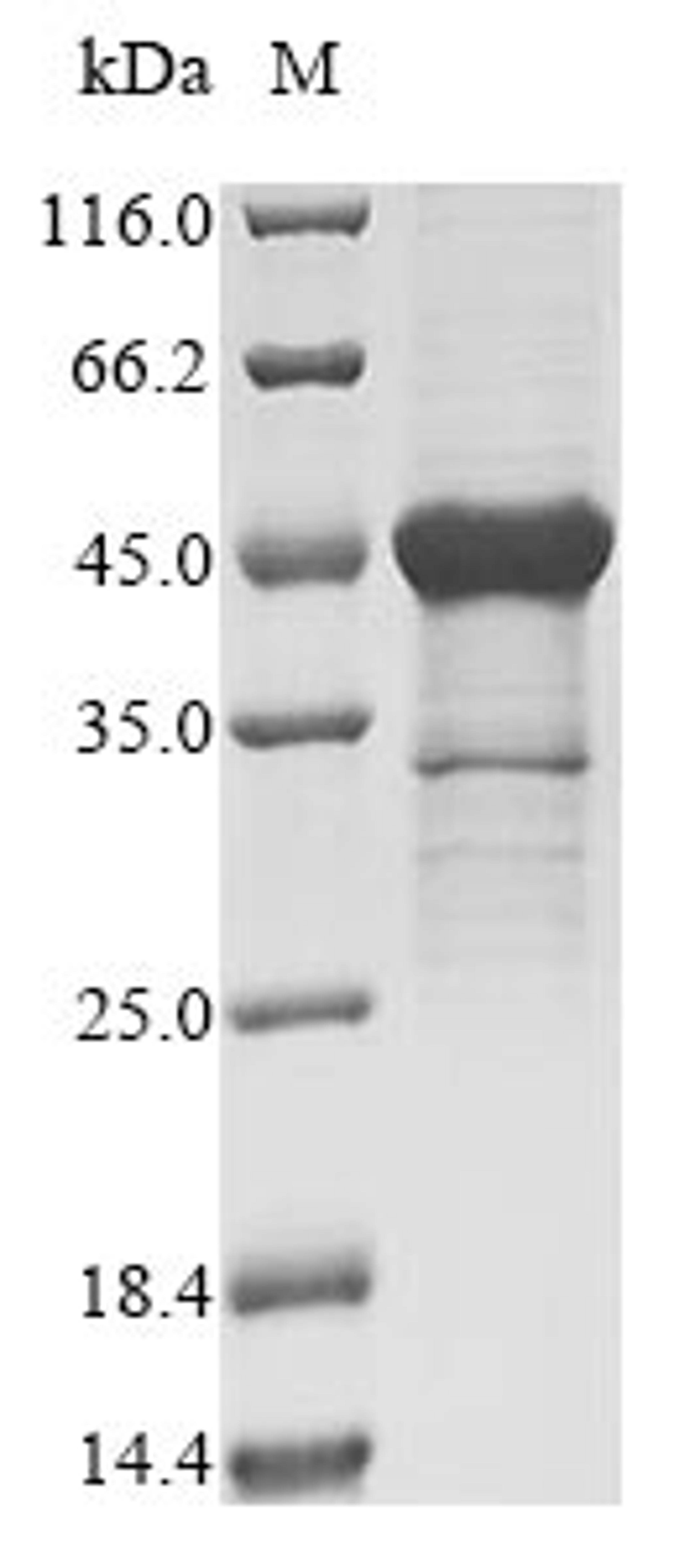 (Tris-Glycine gel) Discontinuous SDS-PAGE (reduced) with 5% enrichment gel and 15% separation gel.