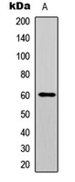 Western blot analysis of HEK293T UV-treated (Lane 1) whole cell lysates using AKT (phospho-Y474) antibody