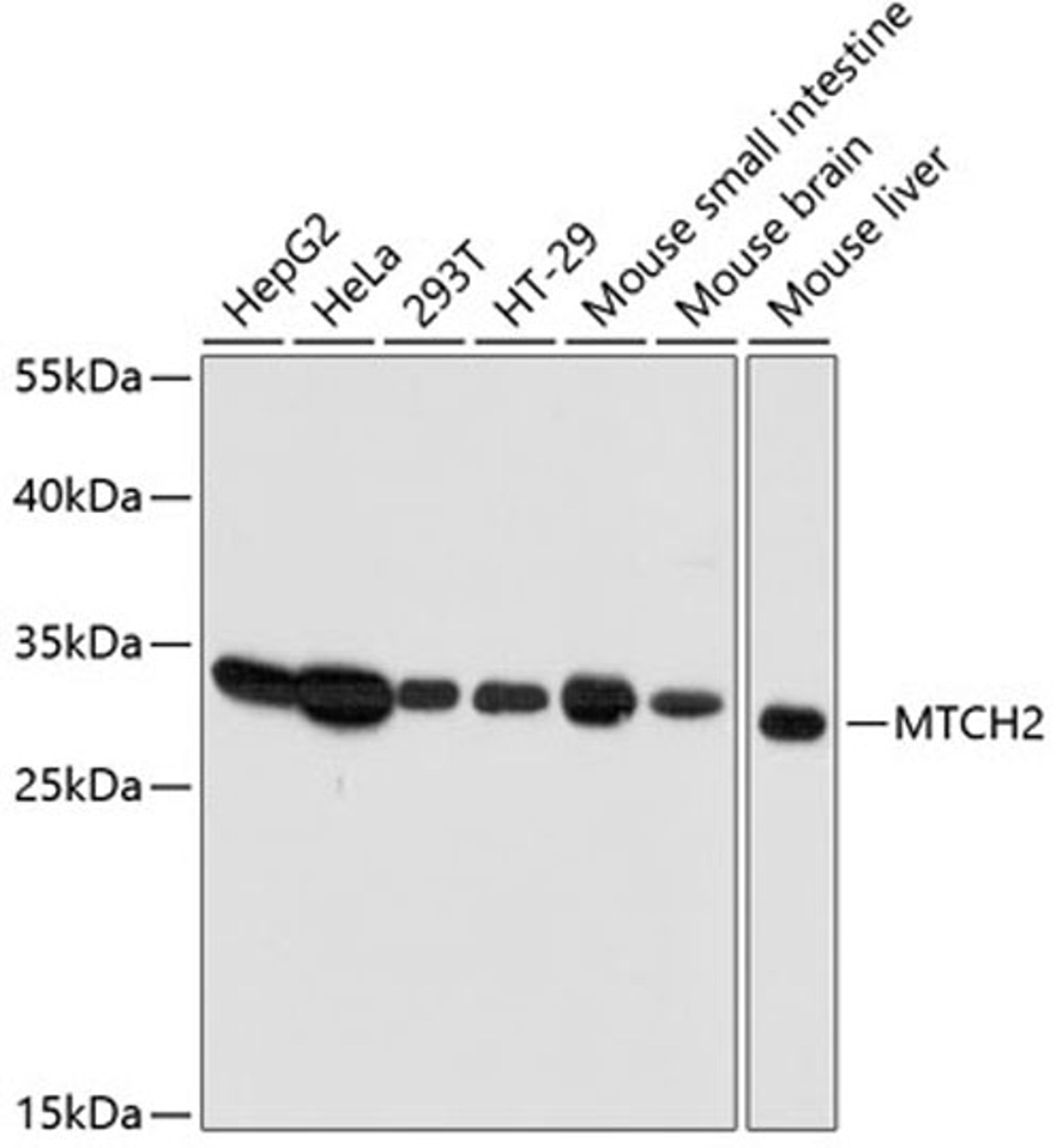 Western blot - MTCH2 antibody (A12934)