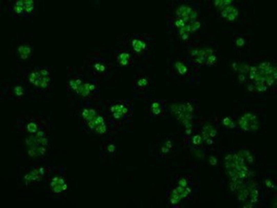 Immunocytochemistry/Immunofluorescence: KIAA1609 Antibody (5D9) [NBP2-02352] - Immunofluorescent staining of HepG2 cells using anti-KIAA1609 mouse monoclonal antibody.