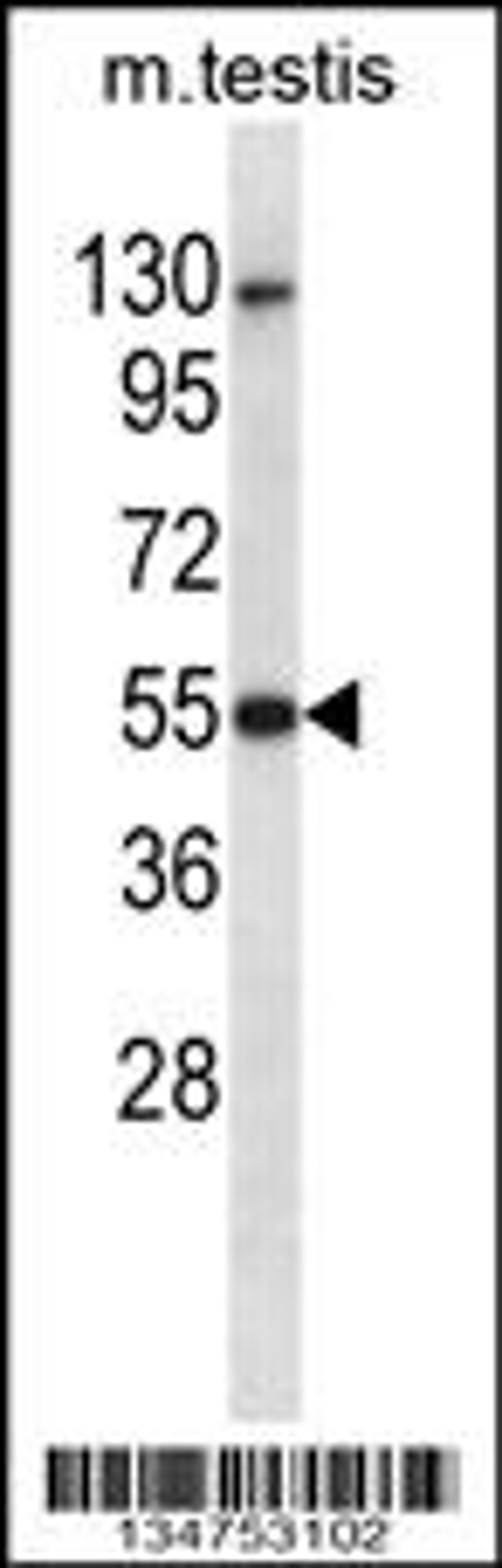 Western blot analysis in mouse testis tissue lysates (35ug/lane).