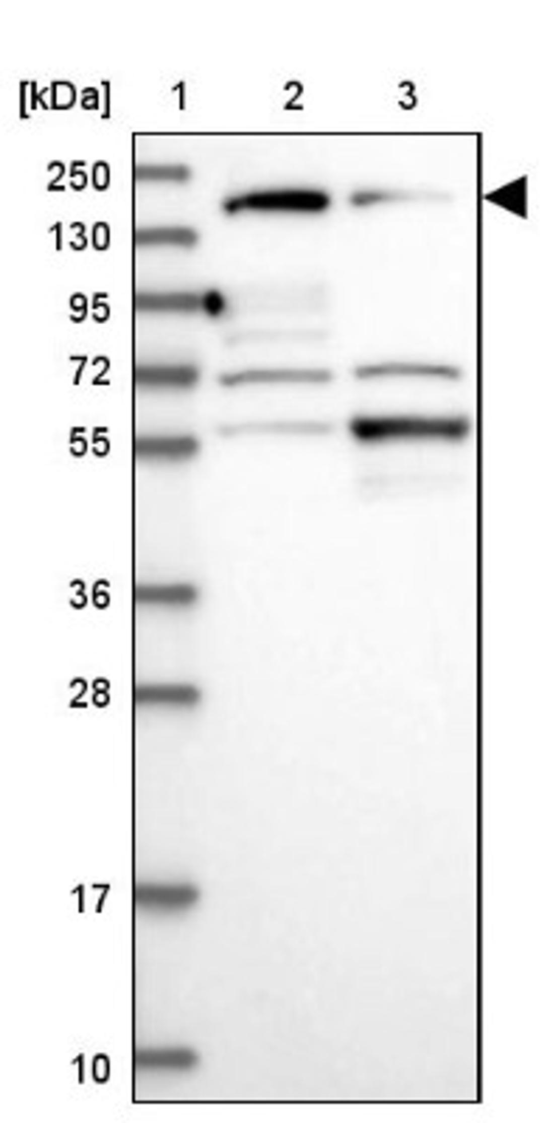 Western Blot: Liprin alpha 1 Antibody [NBP2-38494] - Lane 1: Marker [kDa] 250, 130, 95, 72, 55, 36, 28, 17, 10<br/>Lane 2: RT-4<br/>Lane 3: U-251 MG