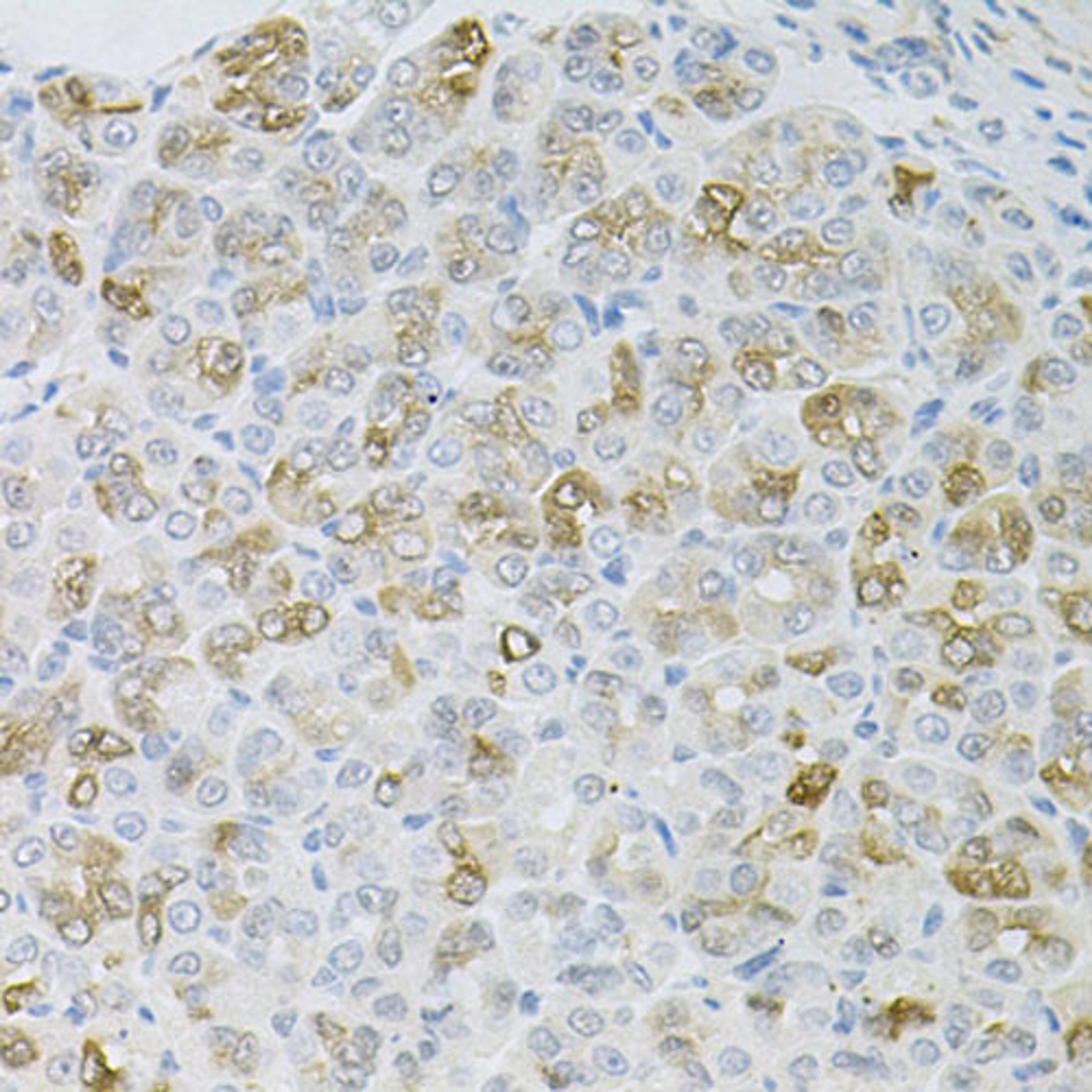 Immunohistochemistry  - HPS1 antibody (A6621)