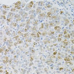 Immunohistochemistry - HPS1 antibody (A6621)