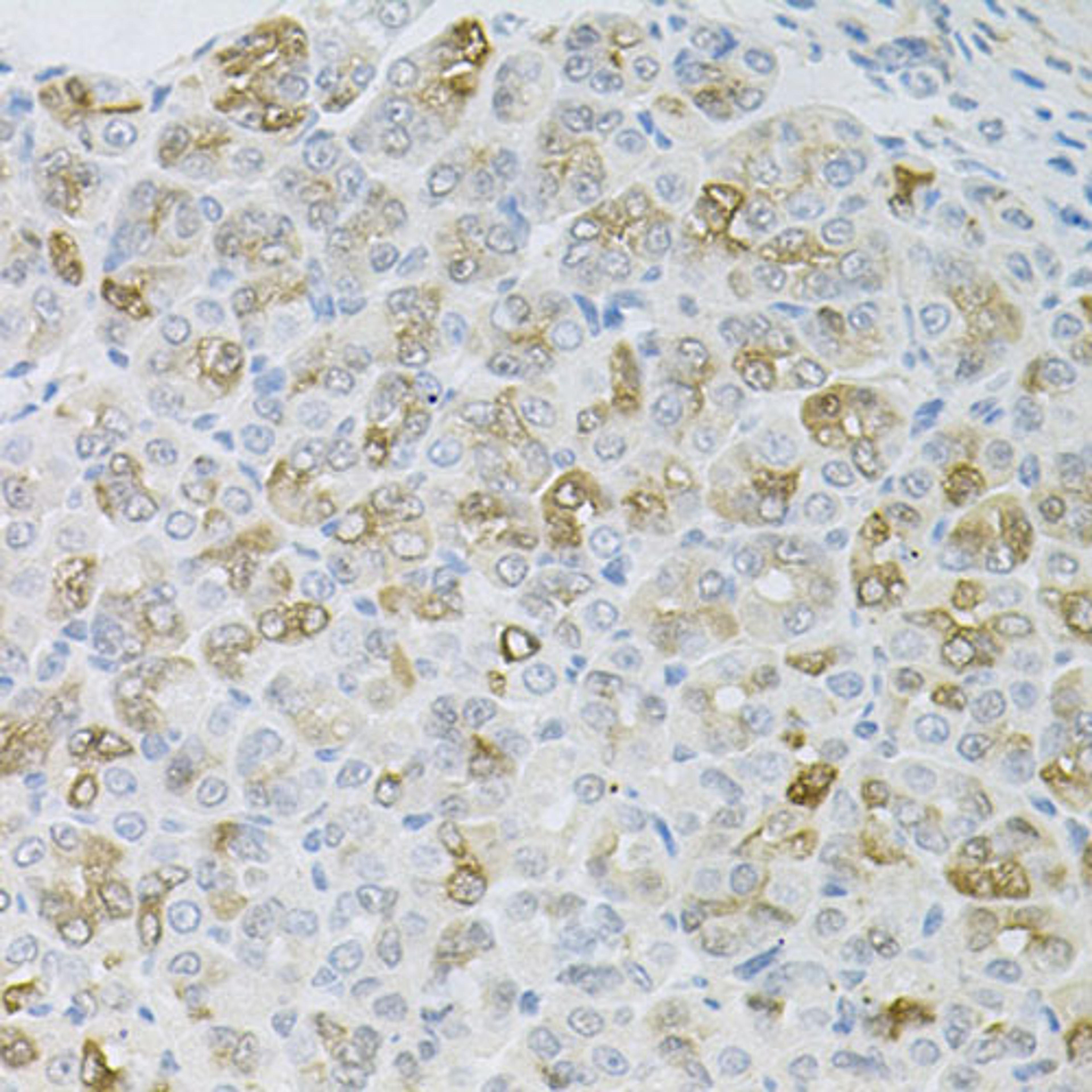 Immunohistochemistry - HPS1 antibody (A6621)