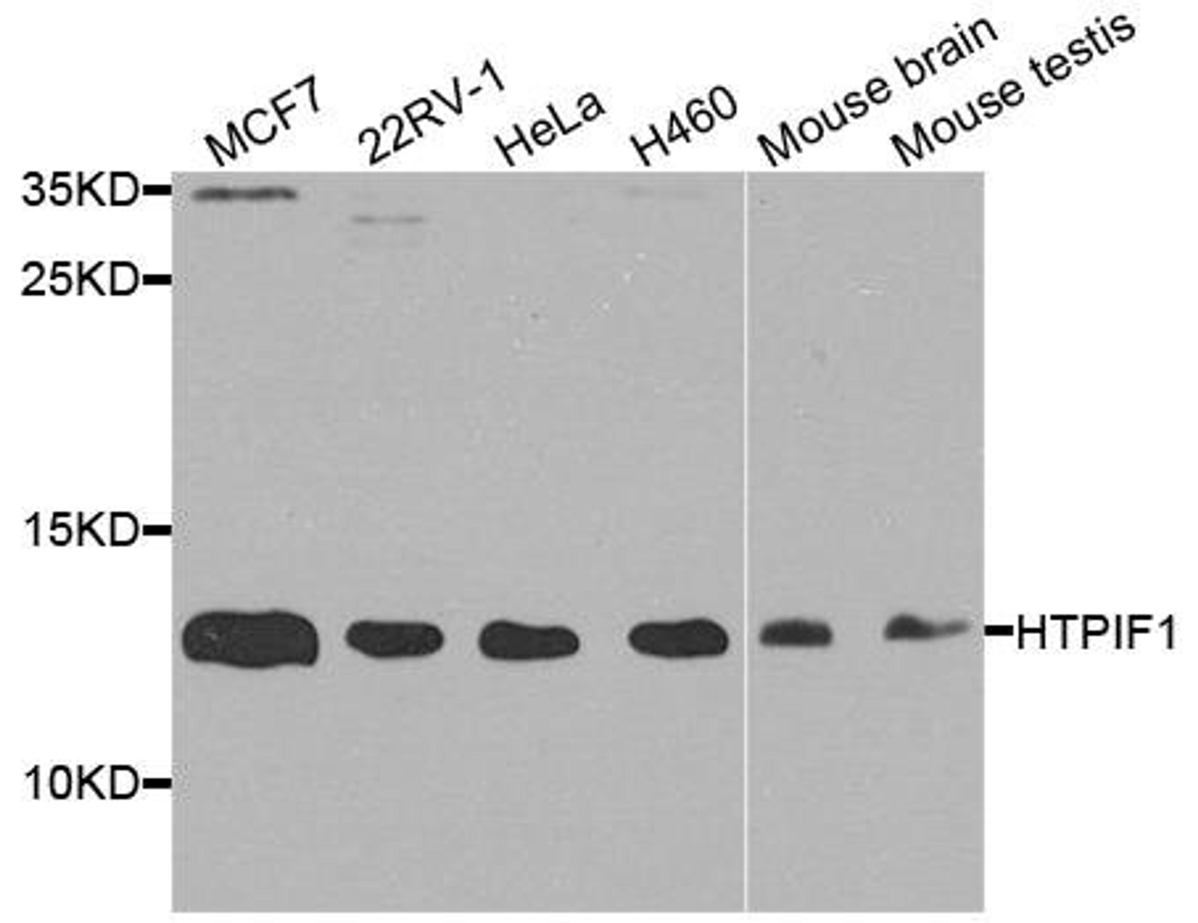 Western blot analysis of extract of various cells using ATPIF1 antibody