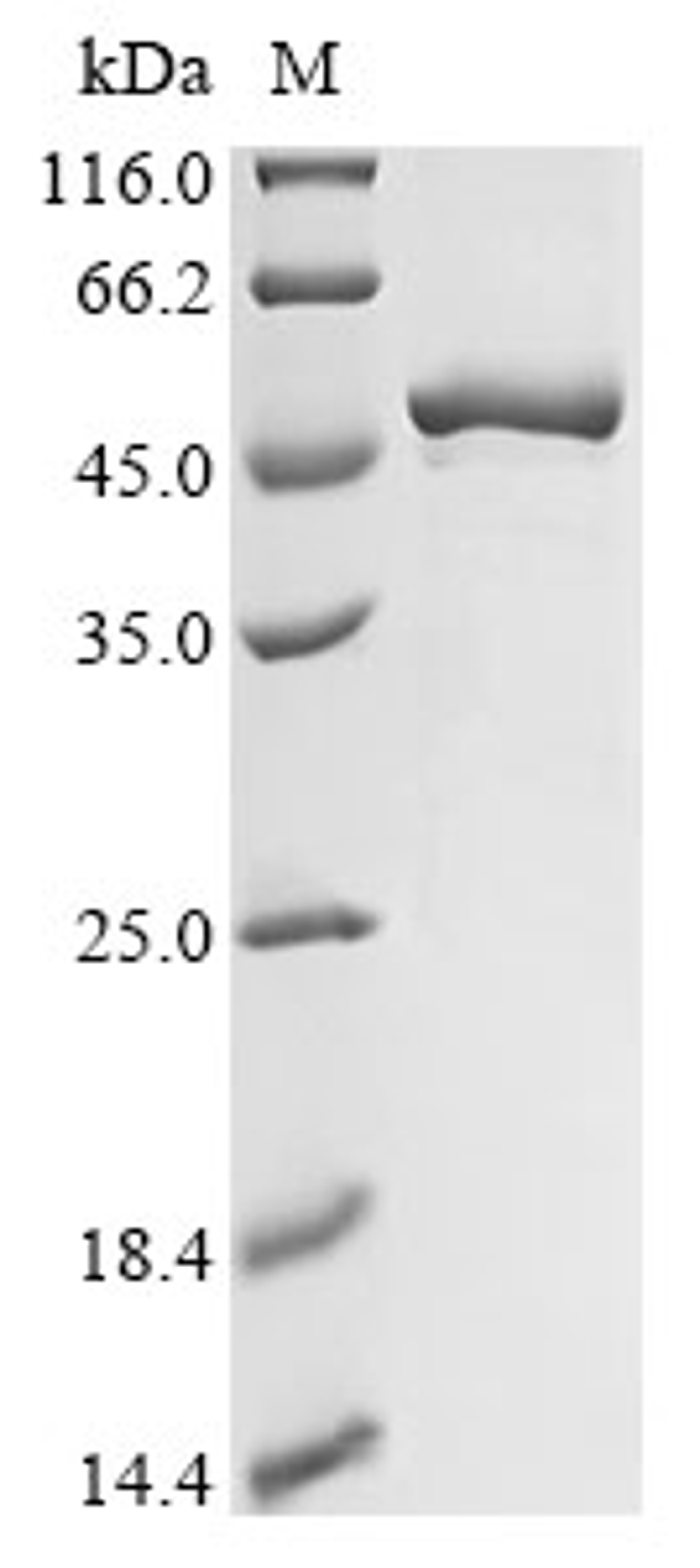 (Tris-Glycine gel) Discontinuous SDS-PAGE (reduced) with 5% enrichment gel and 15% separation gel.
