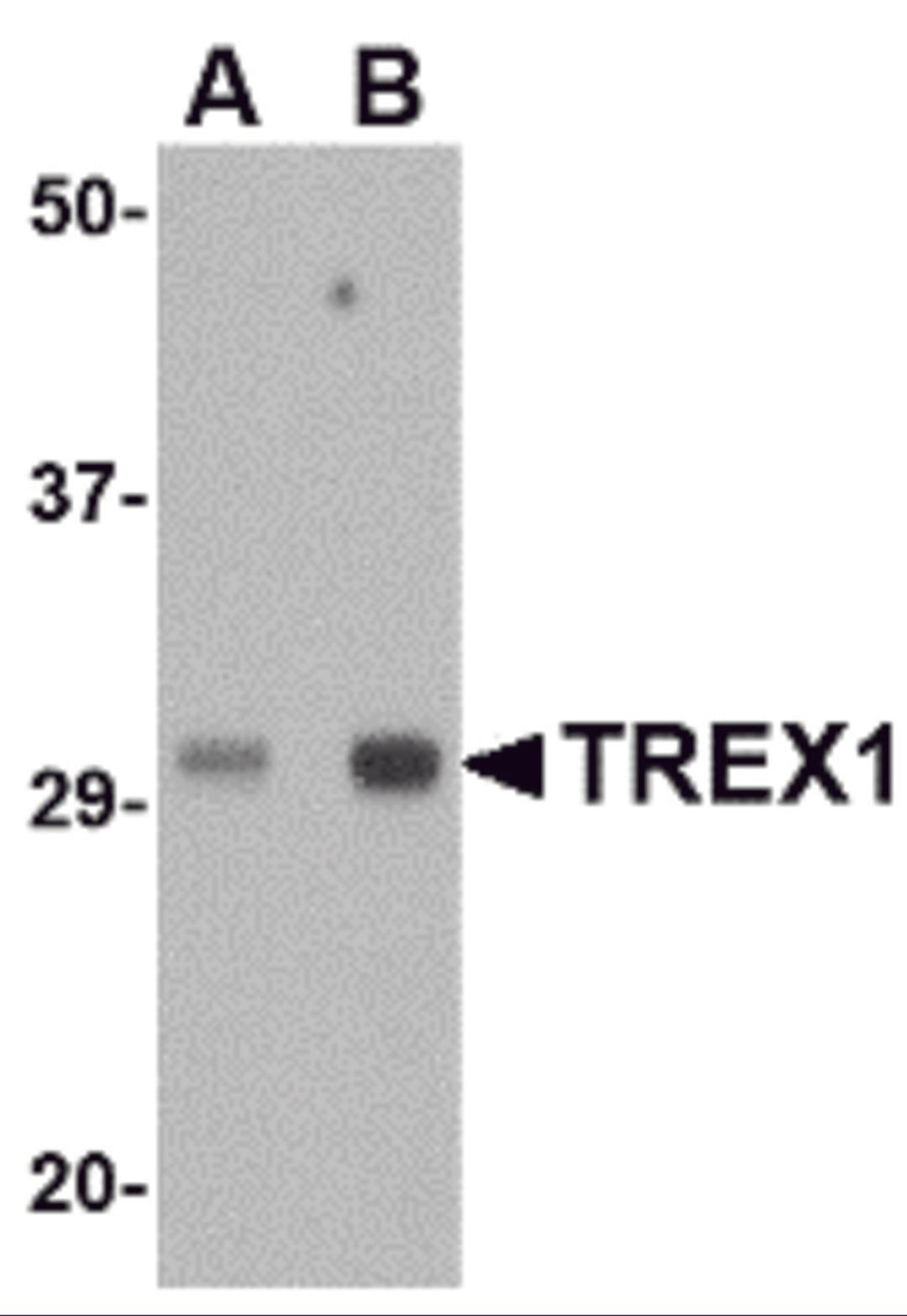 Western blot analysis of TREX1 in human spleen tissue lysate with TREX1 antibody at (A) 0.5 and (B) 1 &#956;g/mL. 