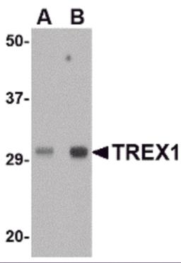 Western blot analysis of TREX1 in human spleen tissue lysate with TREX1 antibody at (A) 0.5 and (B) 1 &#956;g/mL. 