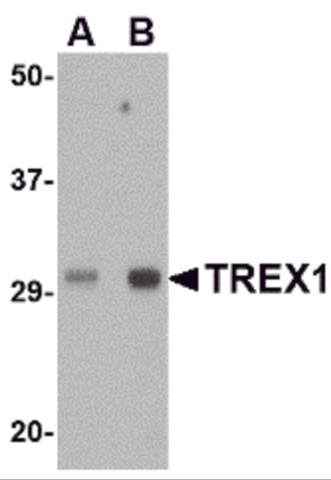 Western blot analysis of TREX1 in human spleen tissue lysate with TREX1 antibody at (A) 0.5 and (B) 1 μg/mL.