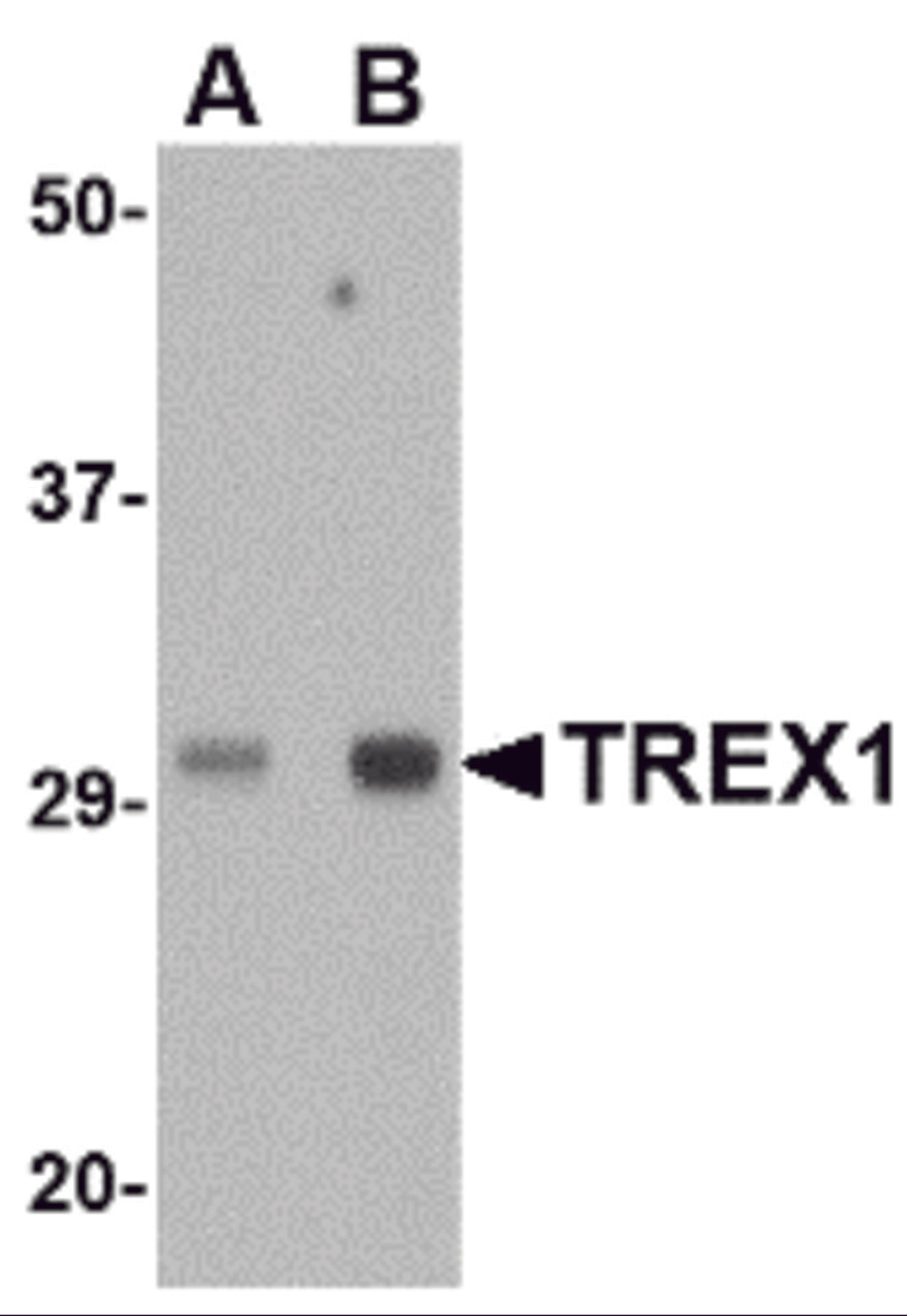 Western blot analysis of TREX1 in human spleen tissue lysate with TREX1 antibody at (A) 0.5 and (B) 1 μg/mL.