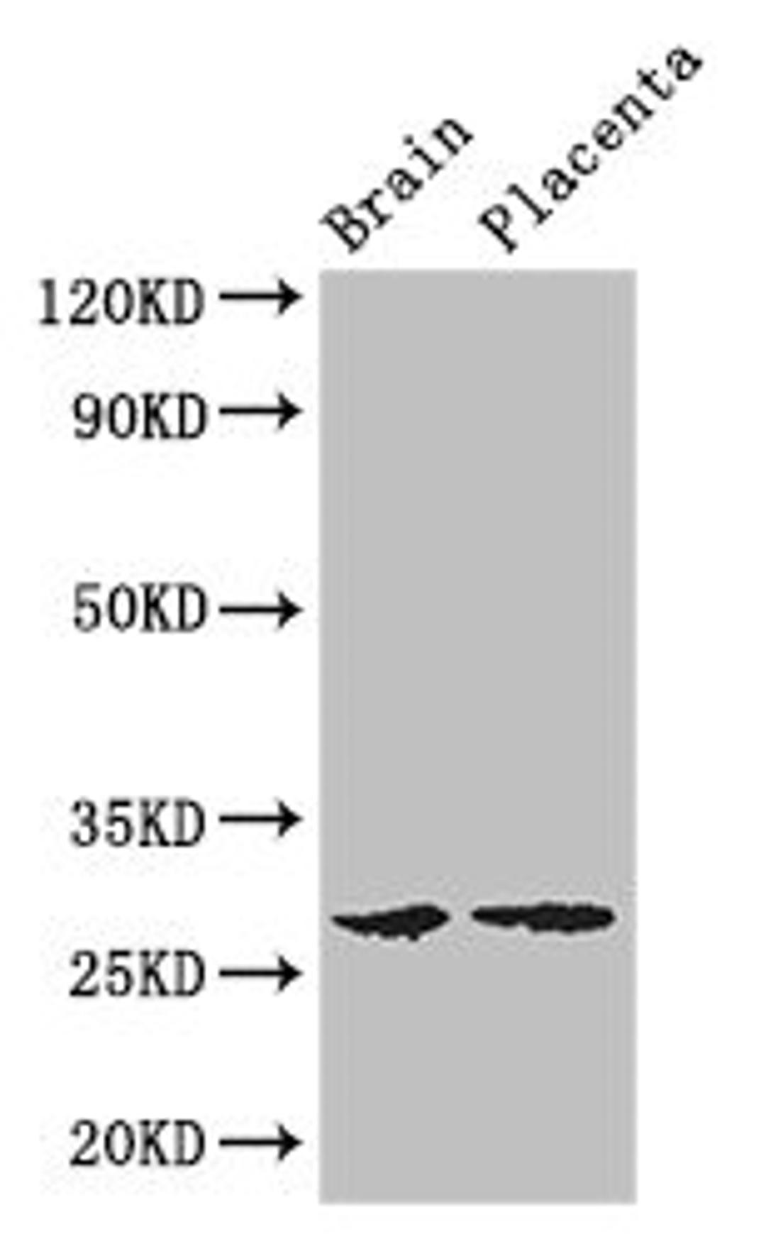 Western Blot. Positive WB detected in: Mouse brain tissue, Human placenta tissue. All lanes: FBXL22 antibody at 3ug/ml. Secondary. Goat polyclonal to rabbit IgG at 1/50000 dilution. Predicted band size: 28 kDa. Observed band size: 28 kDa. 