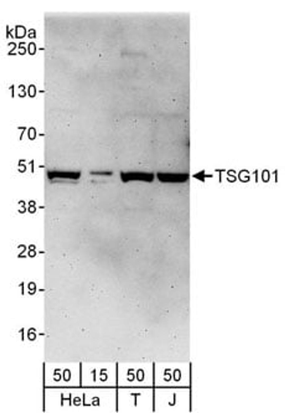 Detection of human TSG101 by western blot.