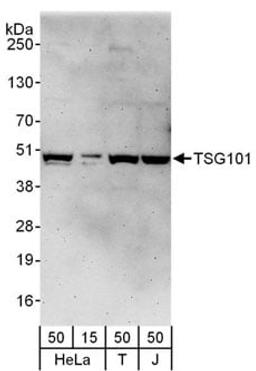 Detection of human TSG101 by western blot.