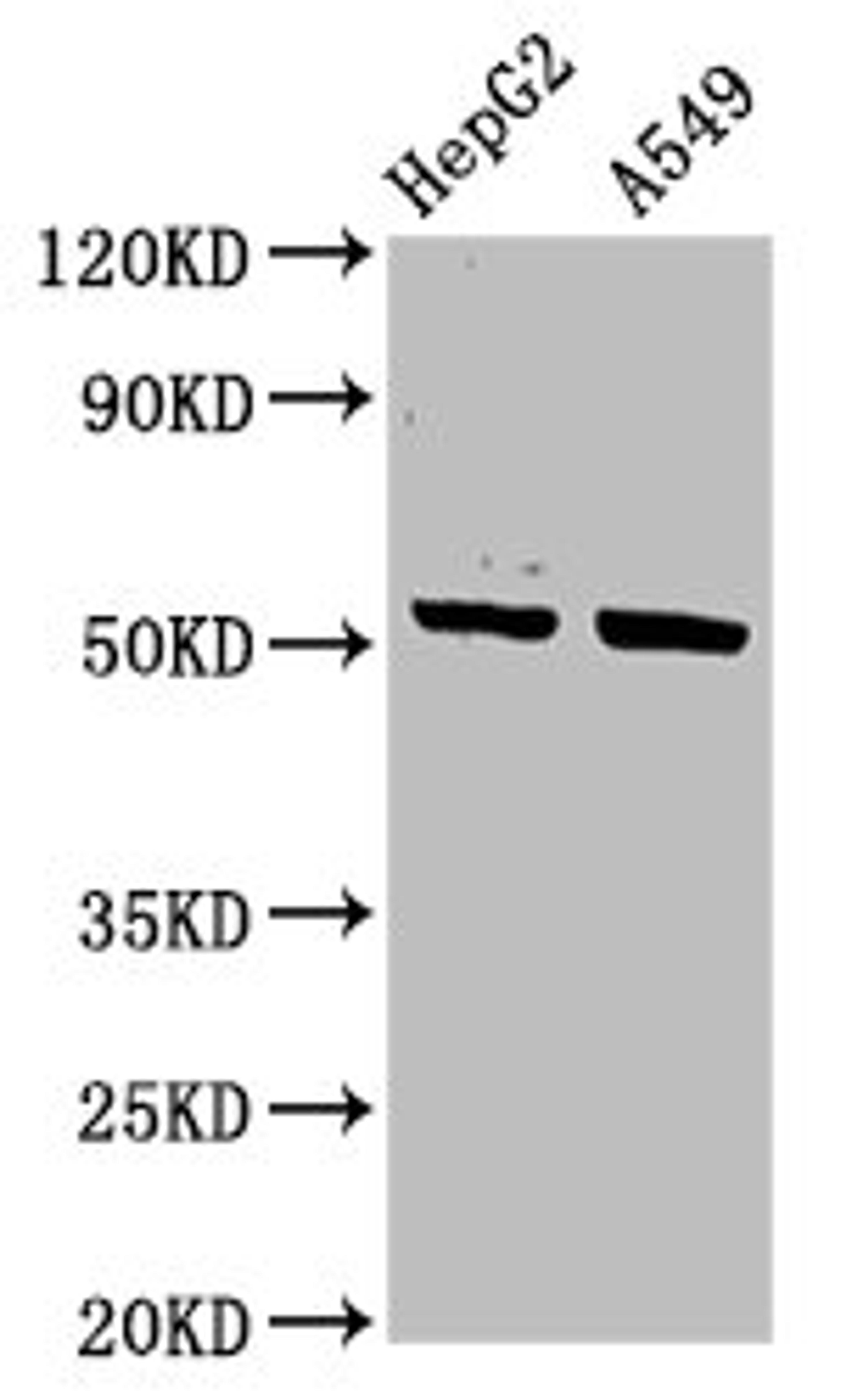Western Blot. Positive WB detected in: HepG2 whole cell lysate, A549 whole cell lysate. All lanes: KRT16 antibody at 3.4ug/ml. Secondary. Goat polyclonal to rabbit IgG at 1/50000 dilution. Predicted band size: 52 kDa. Observed band size: 52 kDa. 