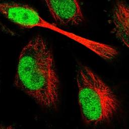 Immunocytochemistry/Immunofluorescence: C9orf142 Antibody [NBP1-94172] - Staining of human cell line U-251 MG shows positivity in nucleus but not nucleoli.