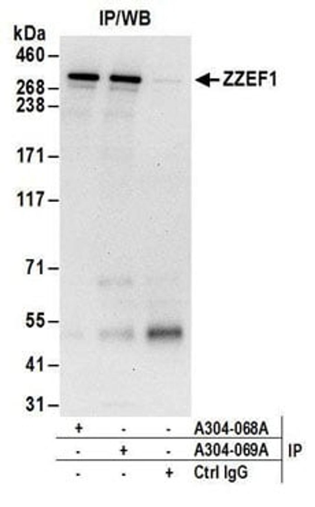 Detection of human ZZEF1 by western blot of immunoprecipitates.